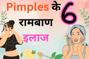 पिम्पलेस के 6 रामबाण इलाज